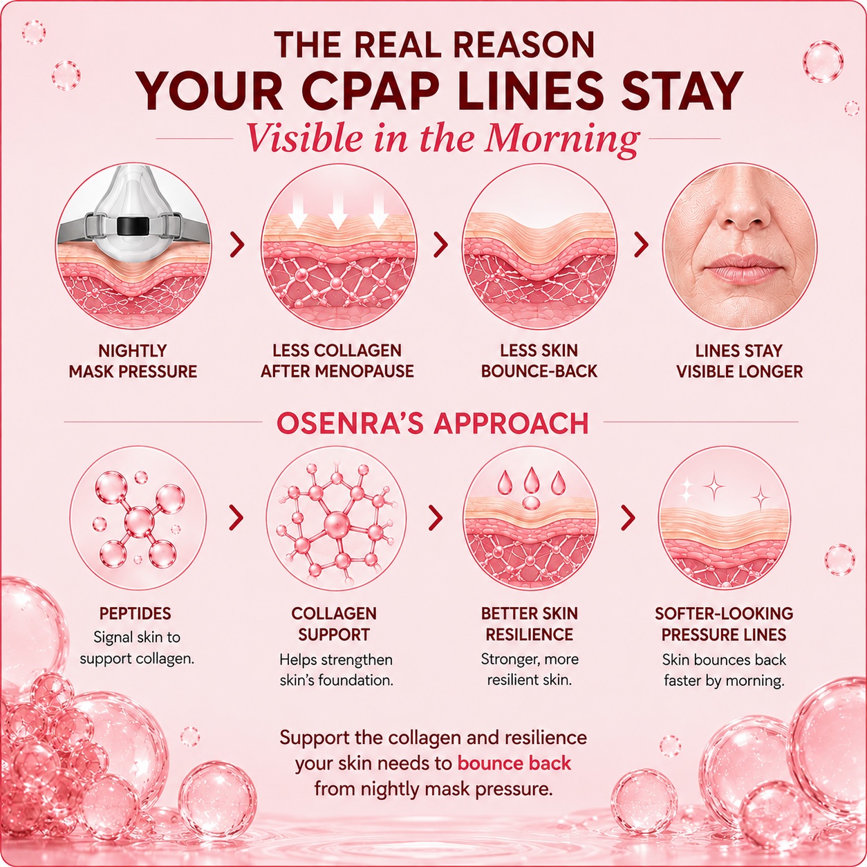 The real reason CPAP lines stay visible and how Osenra helps