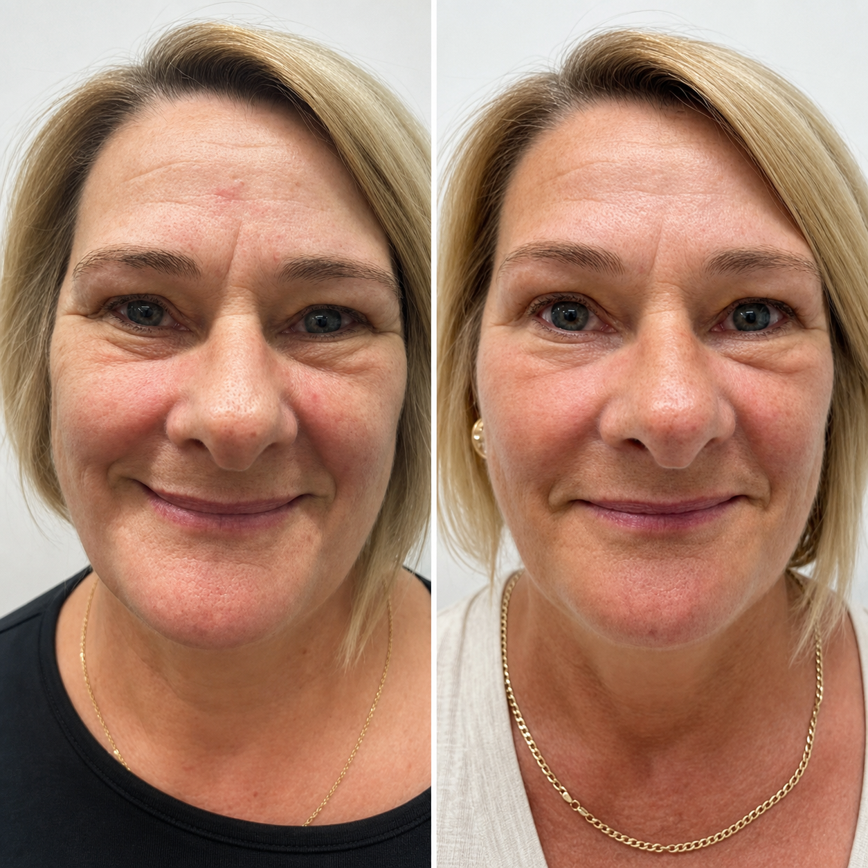 Customer before and after