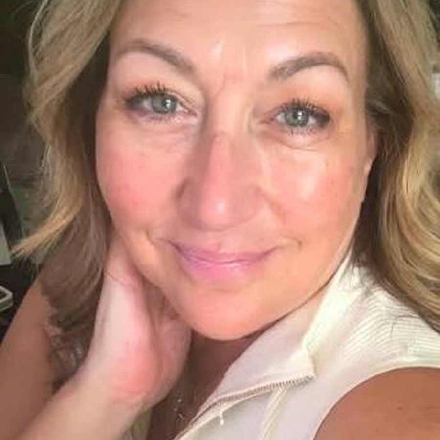 Jennifer M. with firmer skin