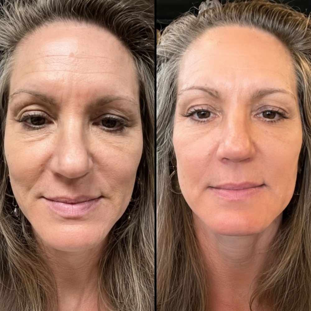 Donna before and after using TECA Skin Repair Cream