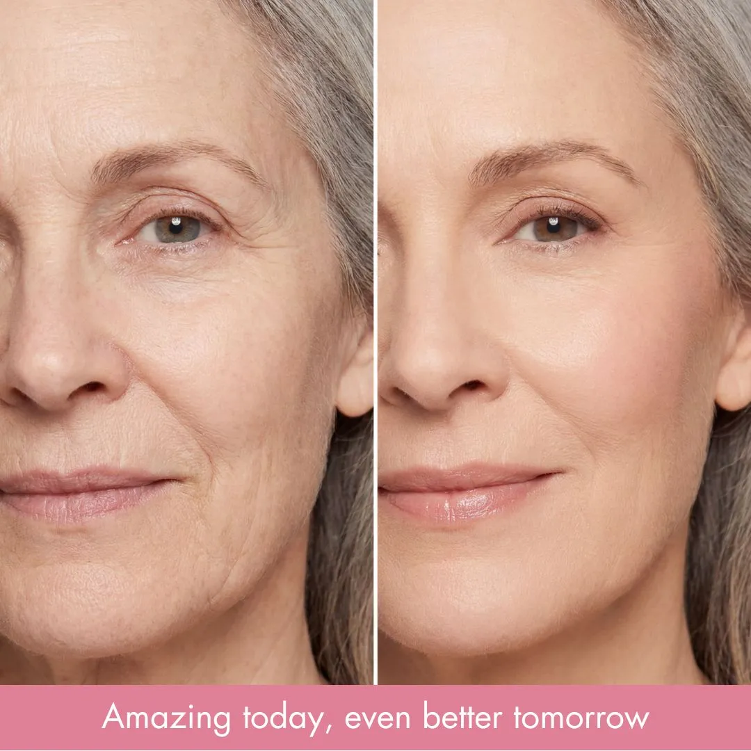 Before and after on a mature woman's skin
