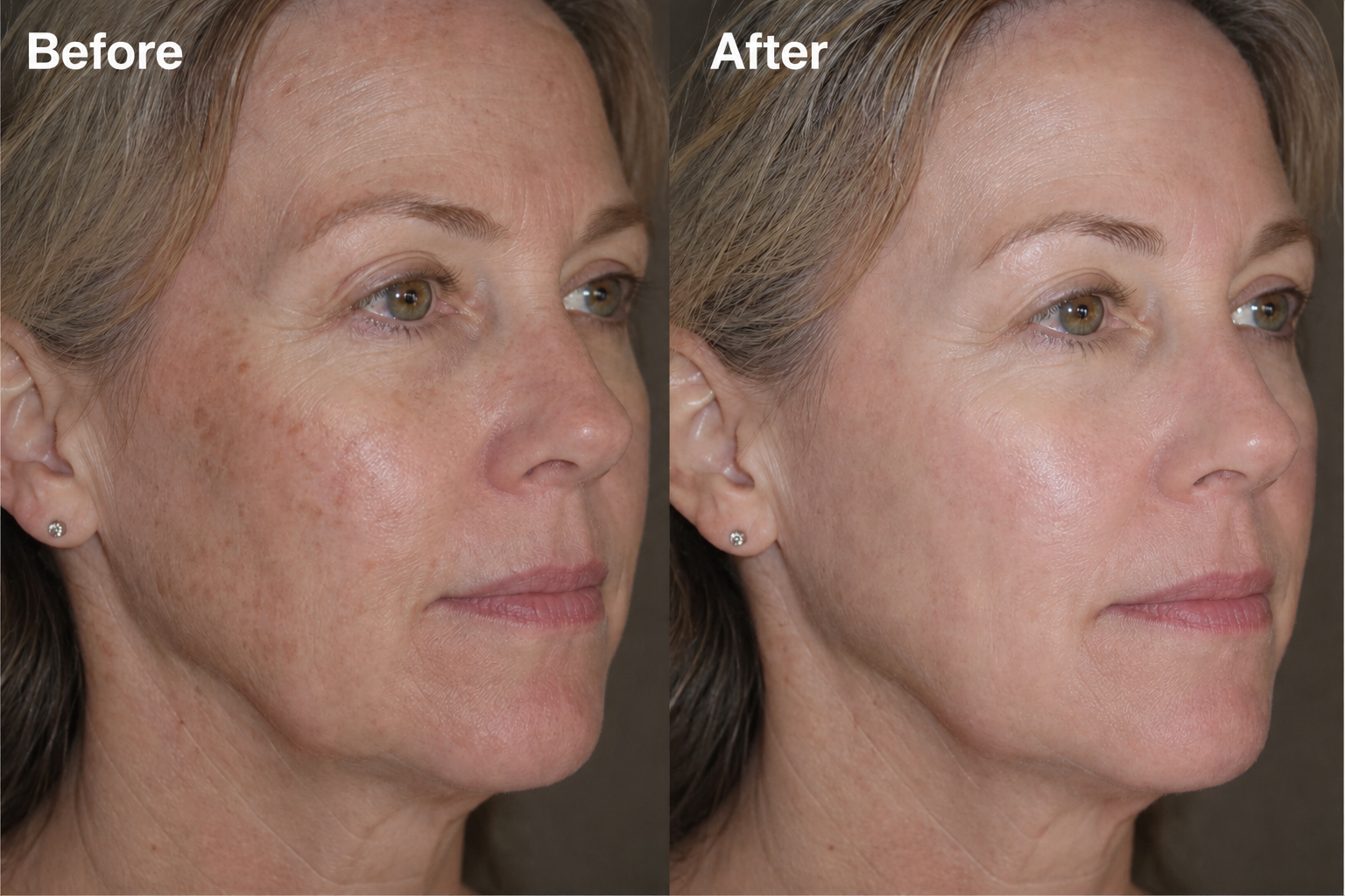 Before and after on a mature woman's skin