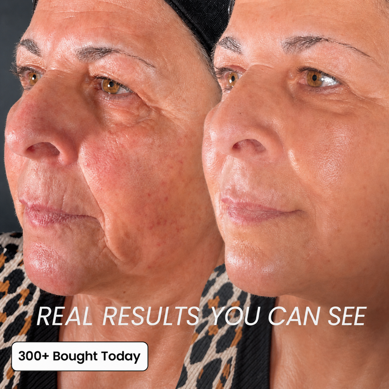 TECA Skin Repair Cream carousel slide 4