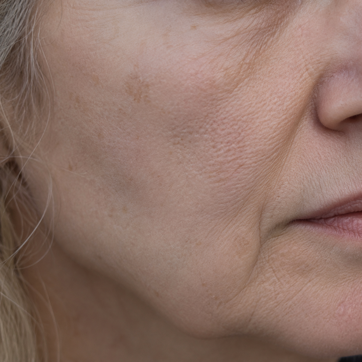 Close-up of dull and tired complexion on mature skin