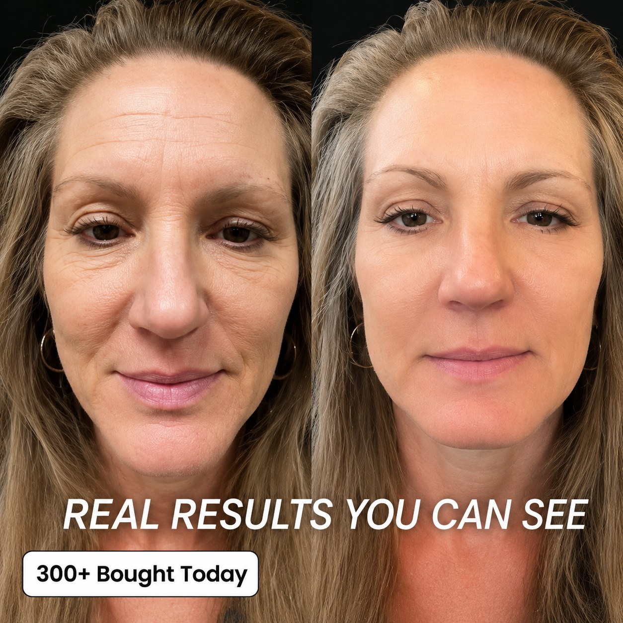 TECA Skin Repair Cream real results before and after second customer